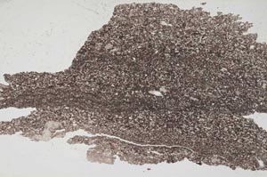 Plane Polarized, S7378