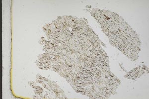 Plane Polarized, S11028