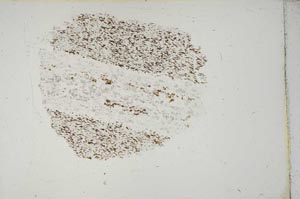 Plane Polarized, S13258