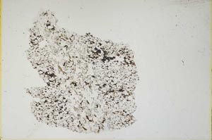 Plane Polarized, S13296