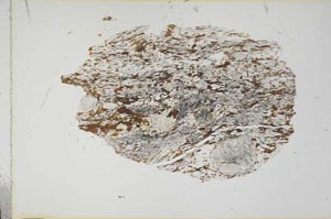 Plane Polarized, S14235