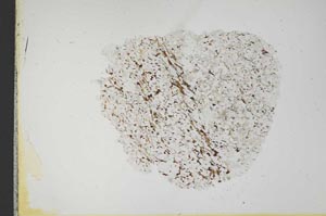 Plane Polarized, S18320