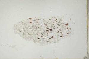 Plane Polarized, S20567