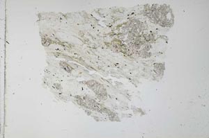 Plane Polarized, S28284