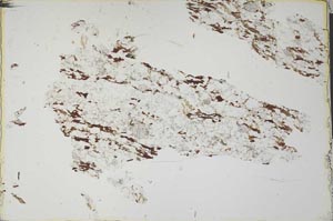 Plane Polarized, S28629