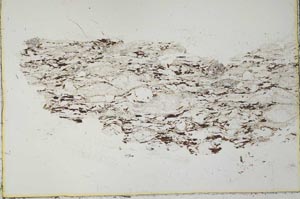 Plane Polarized, S30623