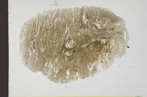 Plane Polarized, S31762