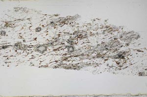 Plane Polarized, S36871