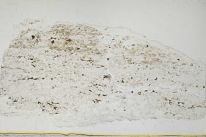 Plane Polarized, S37213