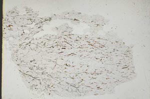 Plane Polarized, S37551