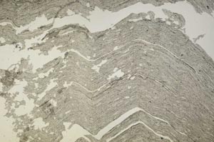 Plane Polarized, S40874/B