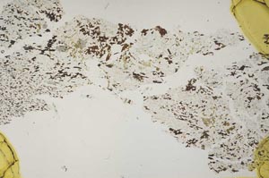 Plane Polarized, S41116