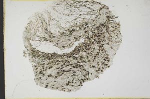 Plane Polarized, S41423