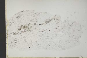 Plane Polarized, S41657
