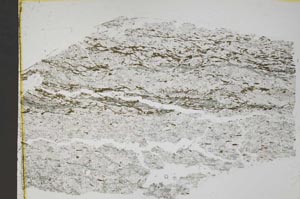 Plane Polarized, S43653