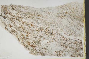 Plane Polarized, S43673