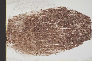Plane Polarized, S44334