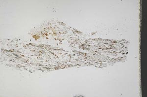 Plane Polarized, S44502