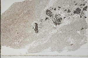 Plane Polarized, S46372