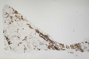 Plane Polarized, S46429/A