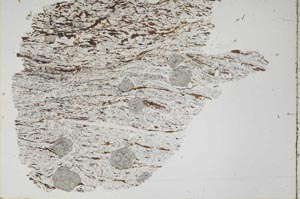 Plane Polarized, S46946