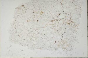 Plane Polarized, S47537