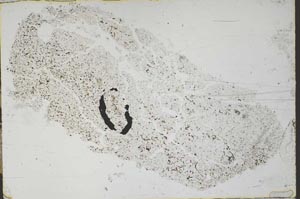 Plane Polarized, S47877