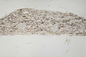 Plane Polarized, S49048