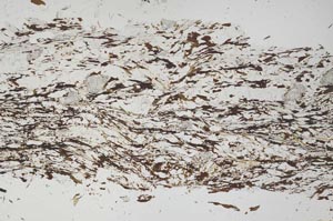 Plane Polarized, S49170