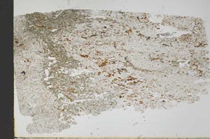 Plane Polarized, S49185