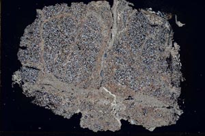 Cross Polarized, S49196