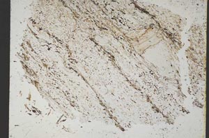 Plane Polarized, S49832