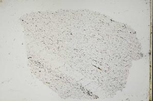 Plane Polarized, S49987