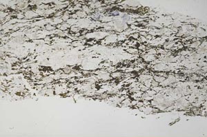 Plane Polarized, S51267