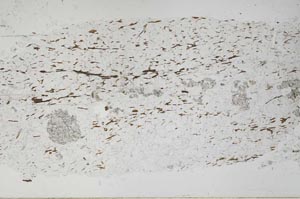Plane Polarized, S51592