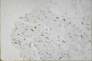 Plane Polarized, S52344