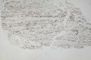 Plane Polarized, S53090
