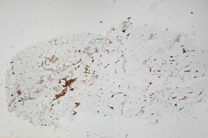 Plane Polarized, S53153
