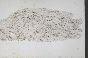 Plane Polarized, S55768