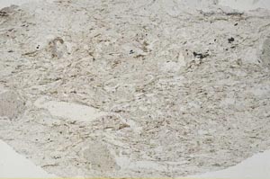 Plane Polarized, S56151