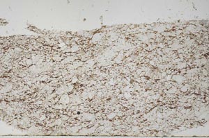 Plane Polarized, S56158