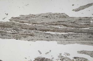 Plane Polarized, S56202