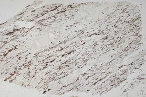 Plane Polarized, S56512