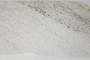 Plane Polarized, S58367