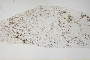 Plane Polarized, S58393