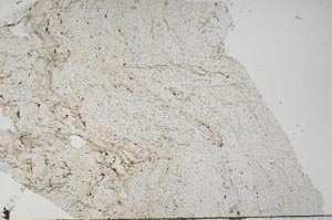 Plane Polarized, S60836