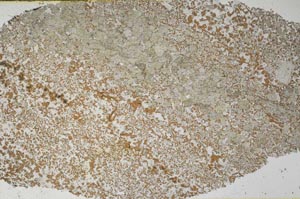 Plane Polarized, S61356