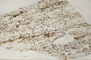 Plane Polarized, S63183