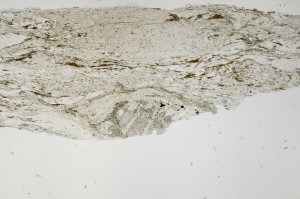 Plane Polarized, S63312