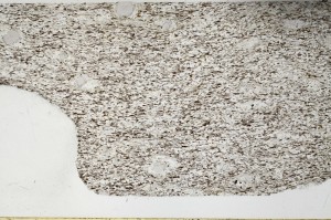 Plane Polarized, S65519